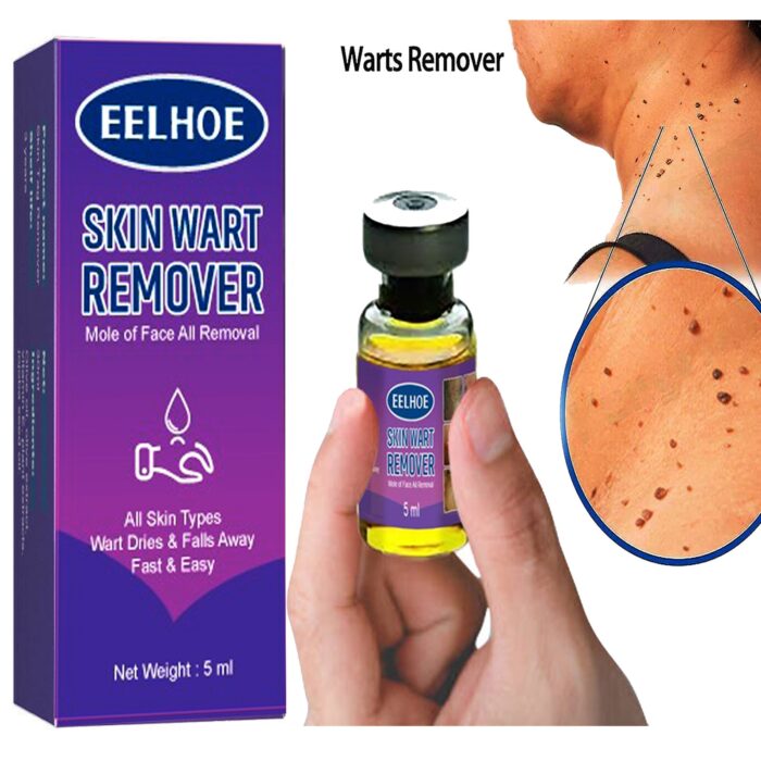 Skin Tag Remover Wart Remover Skin Tag Removal Quickly and Easily Remove