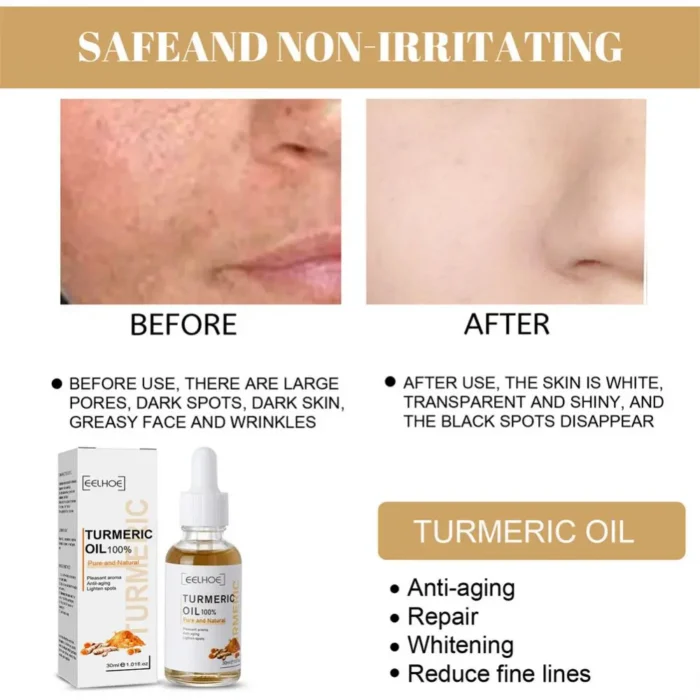 Turmeric Serum Oil Facial Skin Care Serum, Moisturizing the skin Serum, Suitable For Dry Skin, Redness, & Skin Blemishes (colorless 3PC) - Image 3