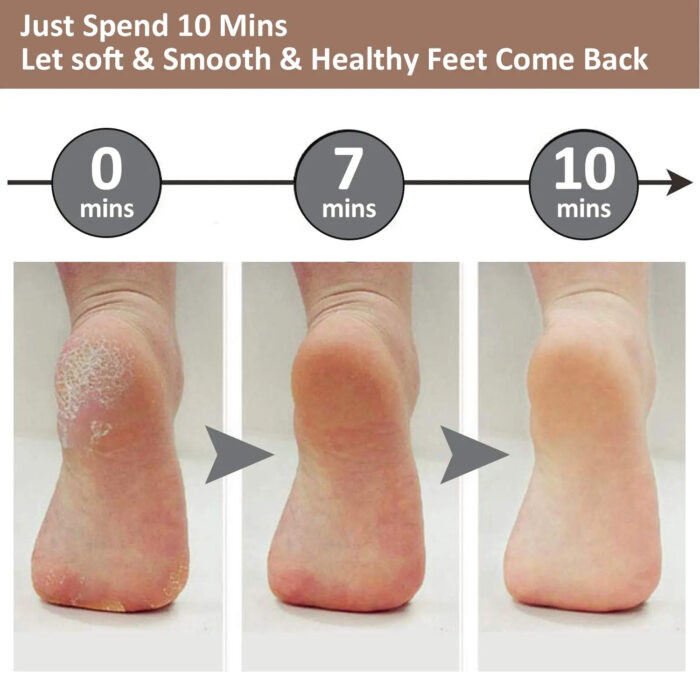 FLAWLESS PEDI ELECTRONIC PEDICURE TOOL - Image 5