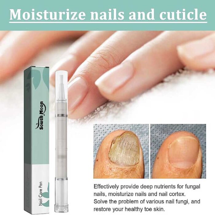 South Moon Nail Repair Pen Anti Nail Fungus Infection Foot Paronychia Removal Treatment Serum Anti-infective Feet Care - Image 3