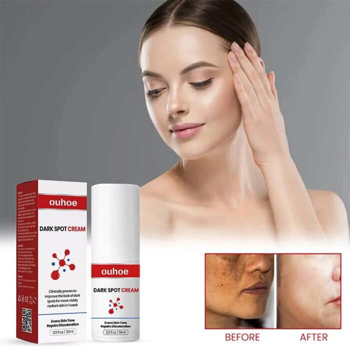 OUHOE Dark Spot Cream - Image 2